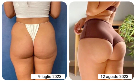 Olio liftante per glutei e torace